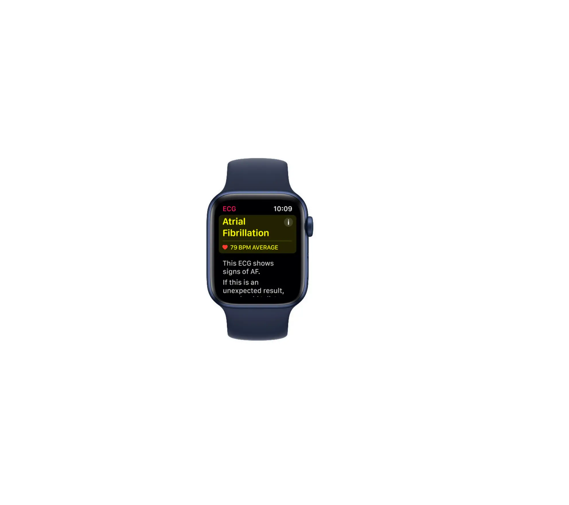 ECG Smart Watch App